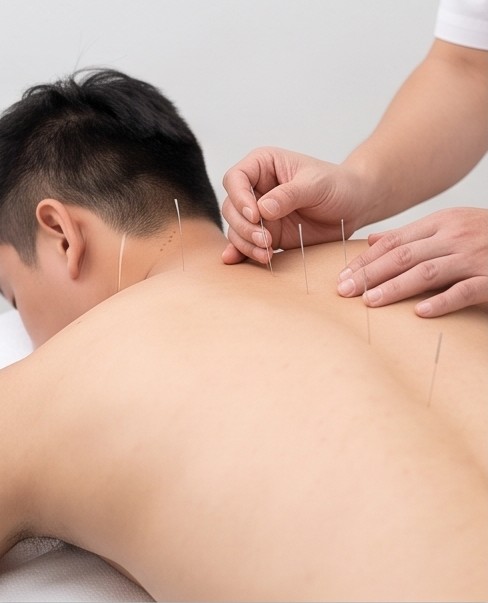針灸照片